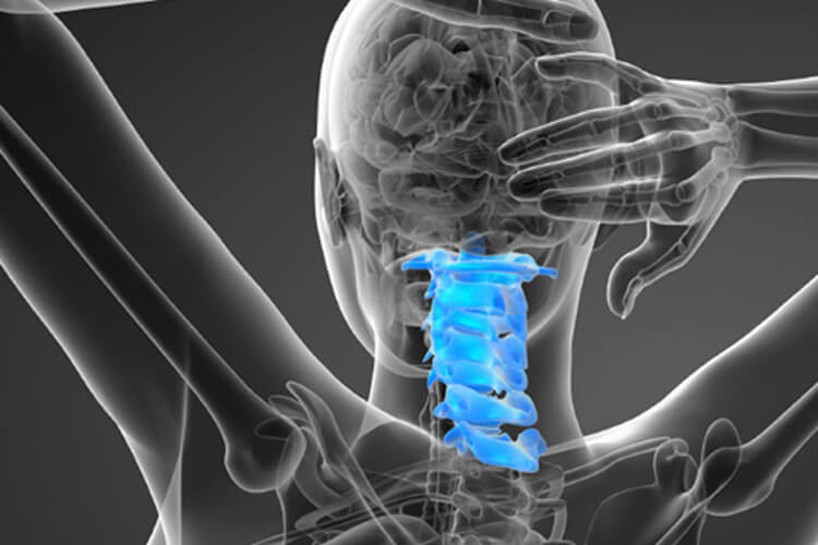 Cervical Fusion – Nevada Brain and Spine Care